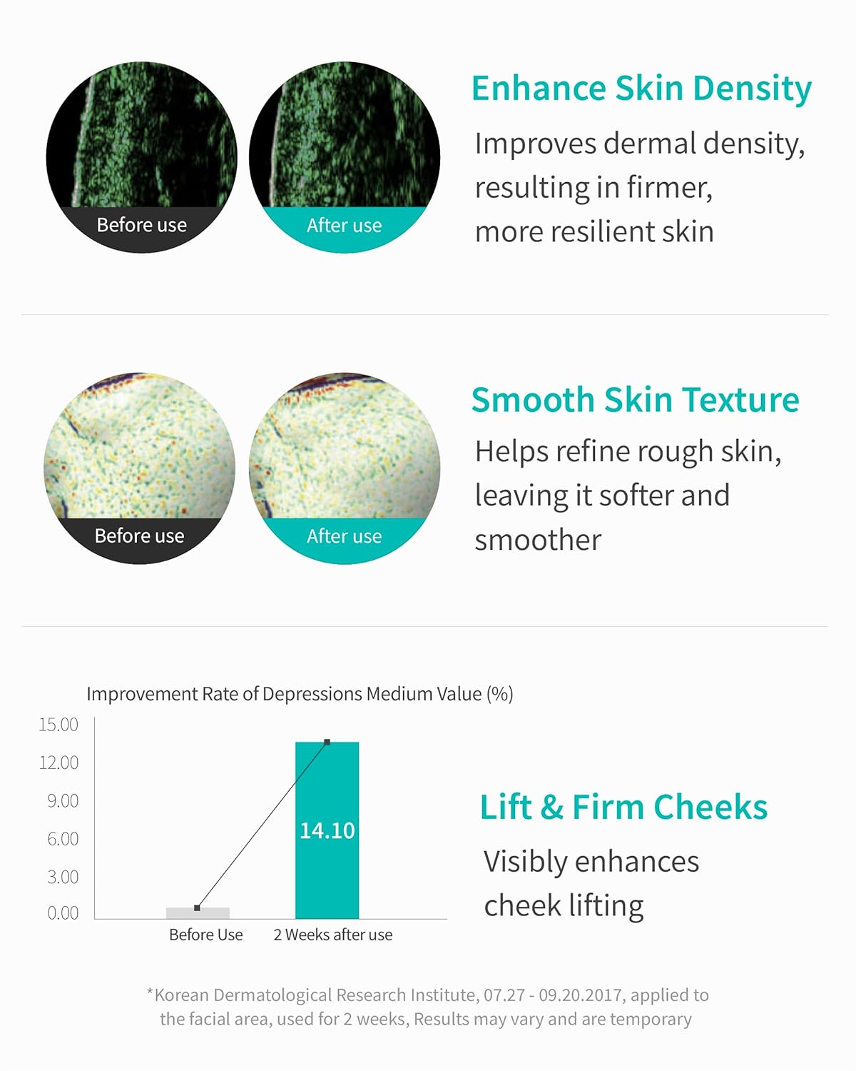 REJURAN Turnover Ampoule