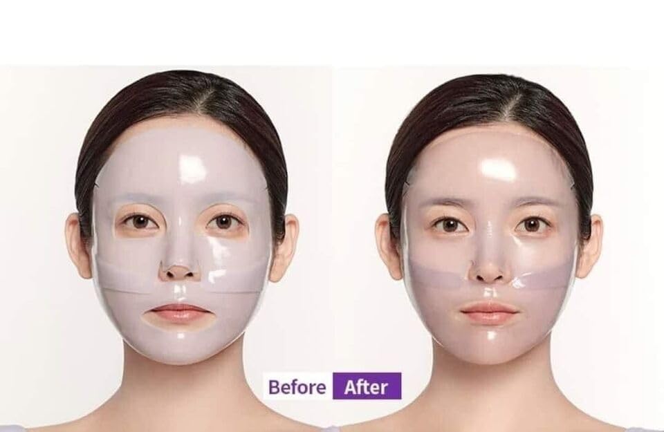 MediAnswer Calming Collagen Mask (Pack of 5)