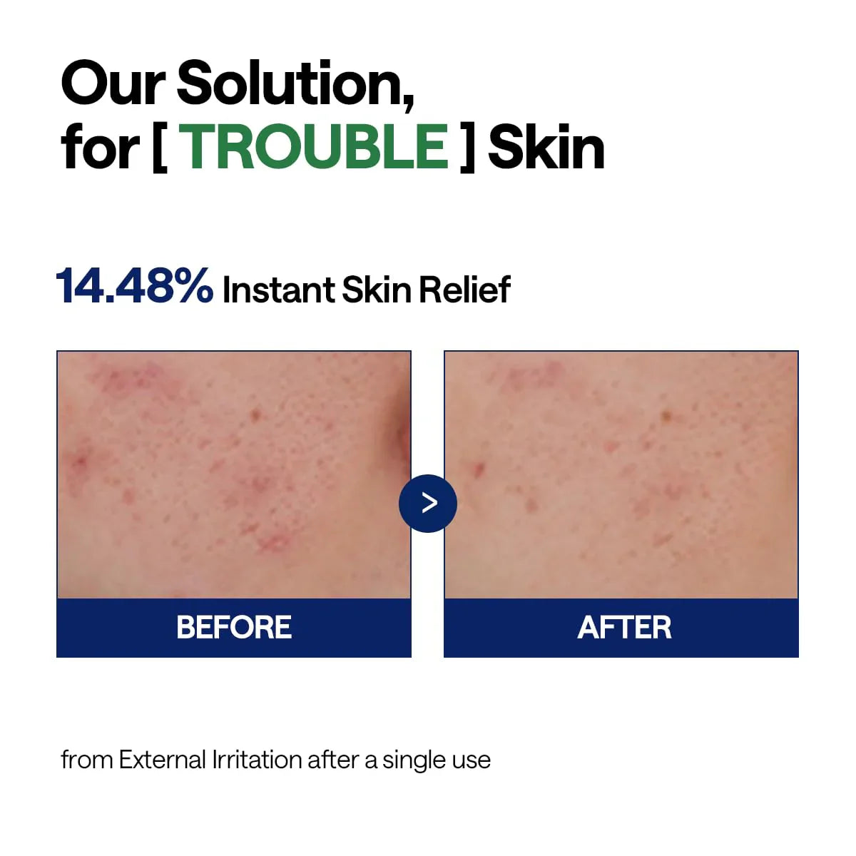 Mediheal Teatree Calming Hydra Serum