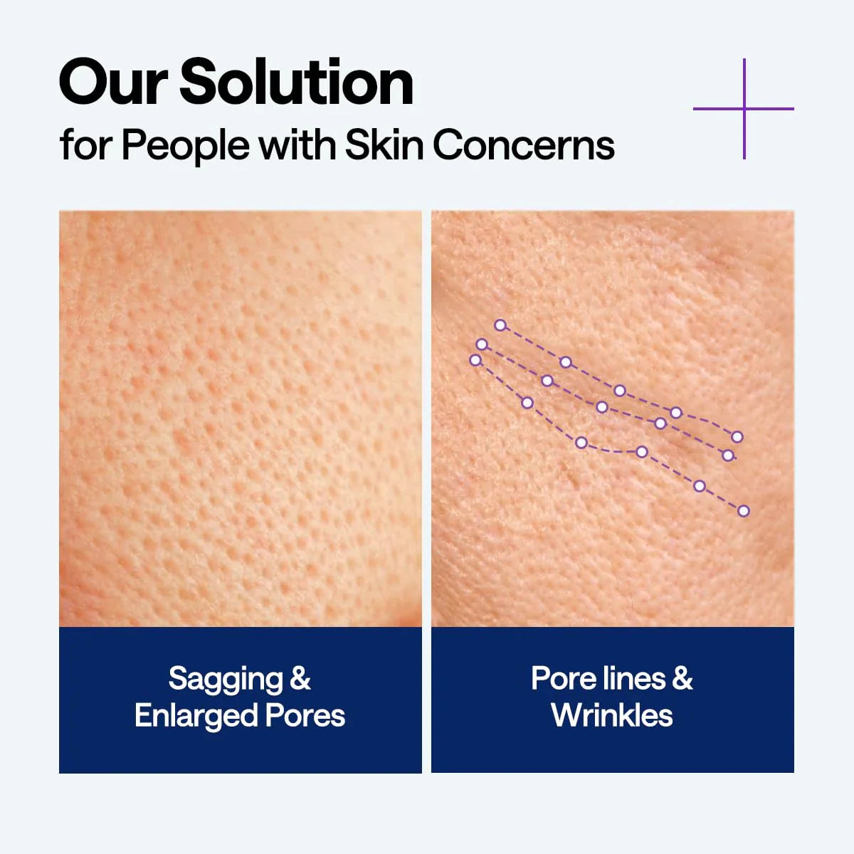 Mediheal PDRN Lifting Serum