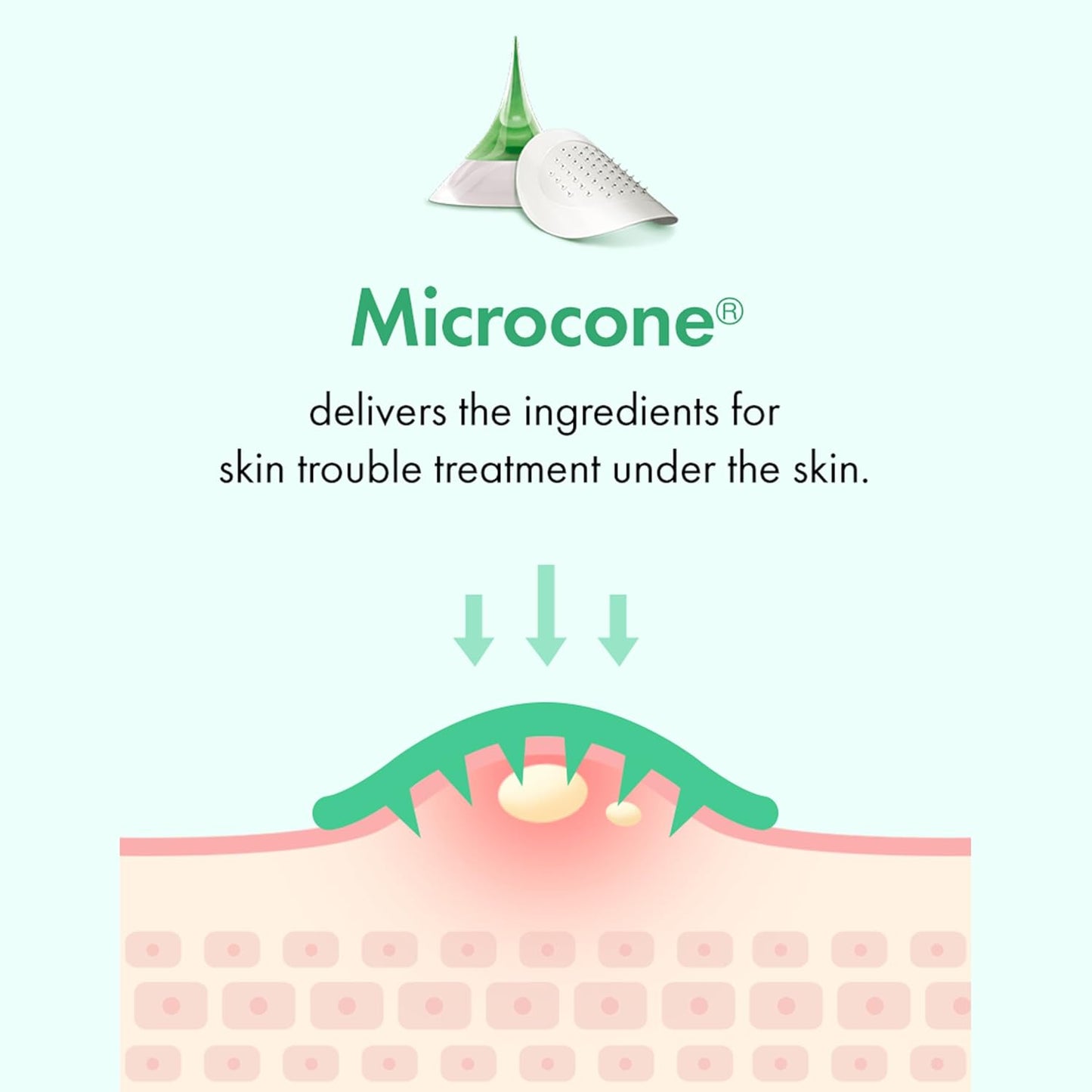 TGI PATCH Microcone Trouble Spot - Patches for Early Stage of Skin Trouble - Invisible (6pc)