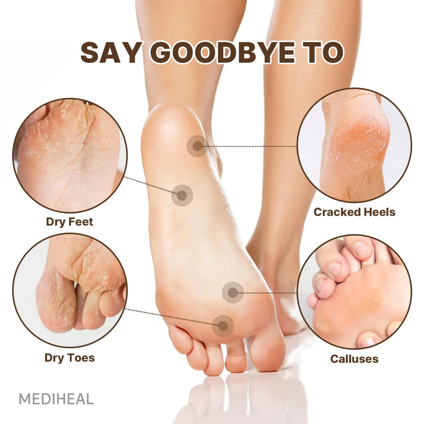 Mediheal Derma Layer Foot Mask (Pack of 5)