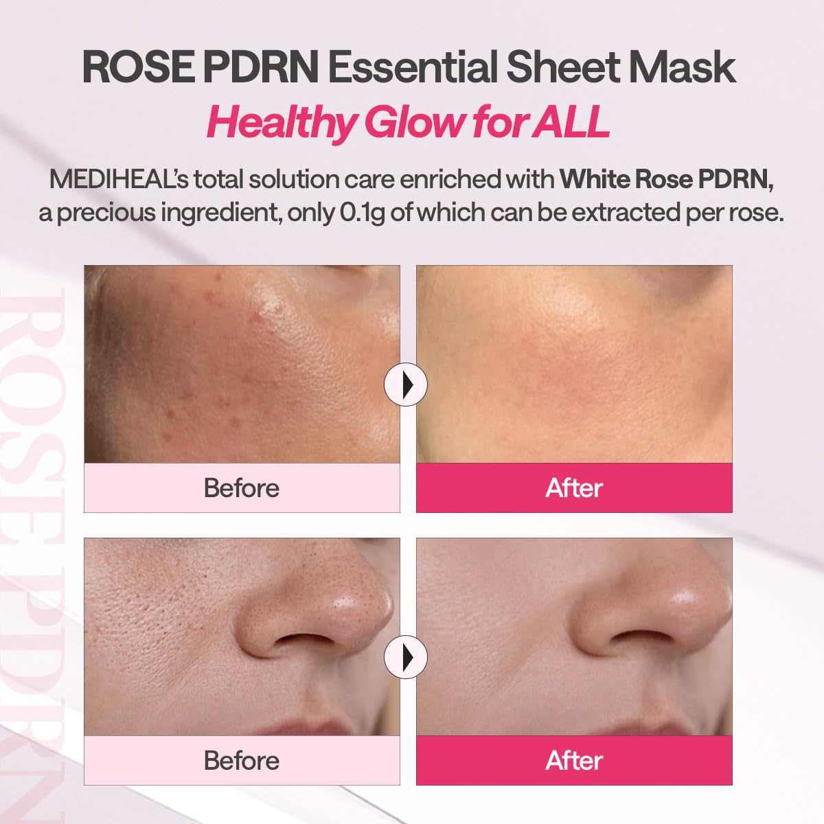 Mediheal Rose Pdrn Essential Mask (Pack of 4)