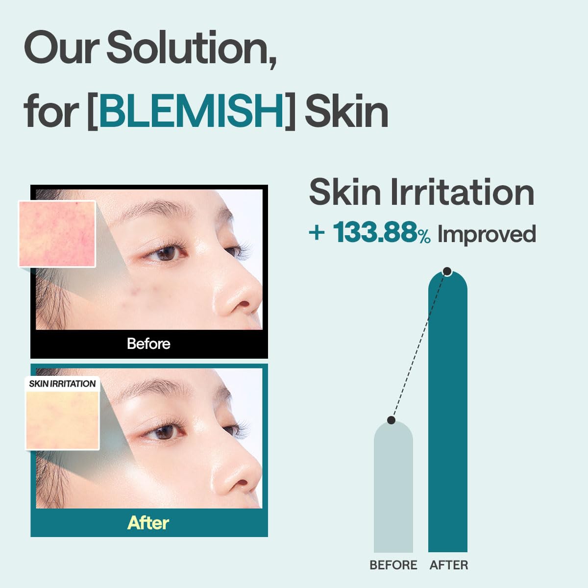 Mediheal Madecassoside Essential Mask (Pack of 4)