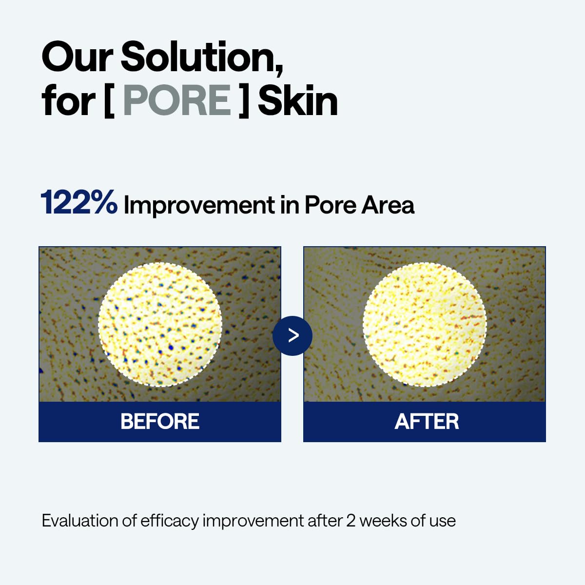 Mediheal Madecassoside Pore Repair Serum with Spicule