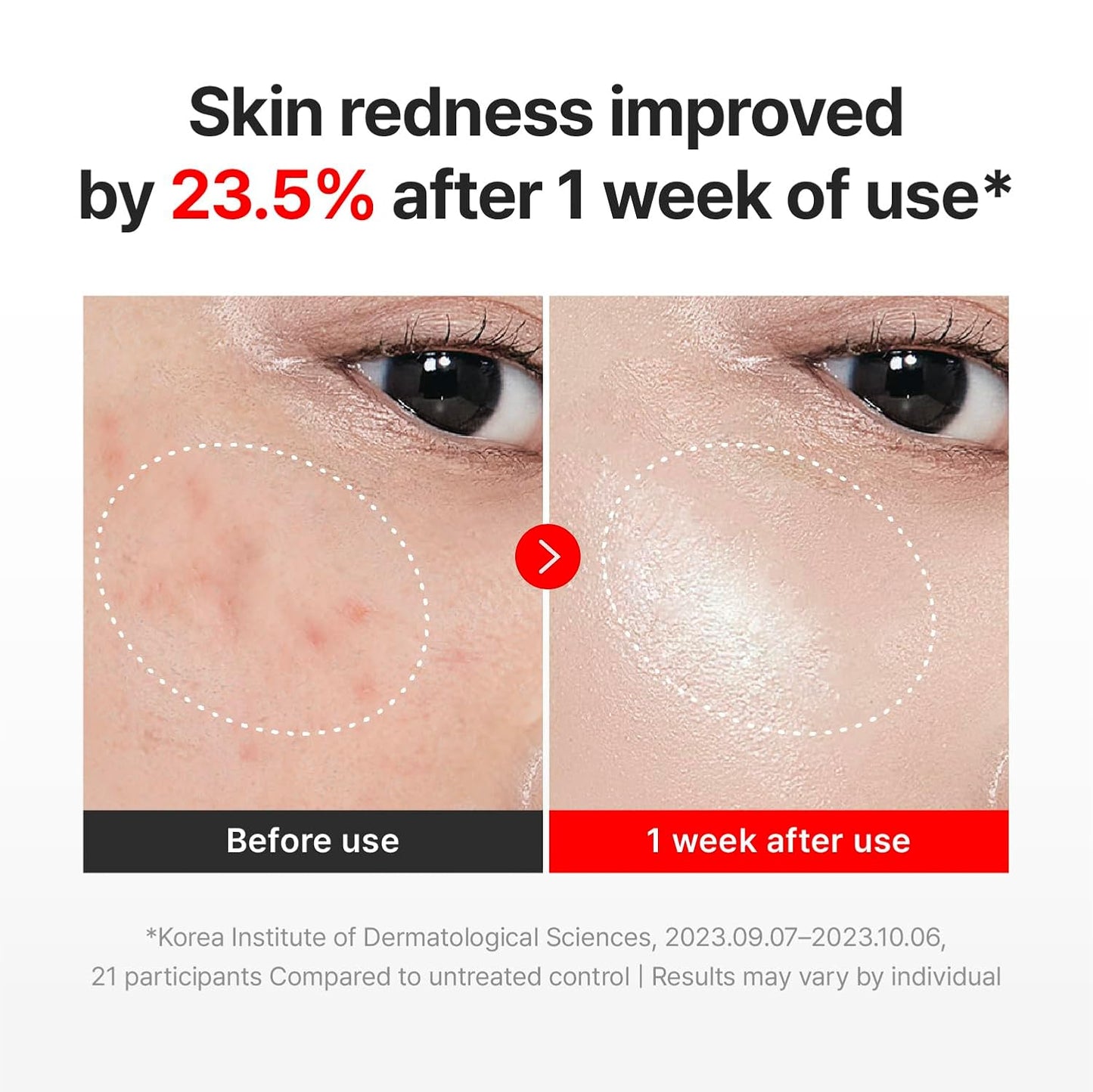 Centellian 24 Madeca Cream Time Reverse | Anti-Aging Korean Cream with TECA & Collagen | Wrinkle Care & Skin Firming
