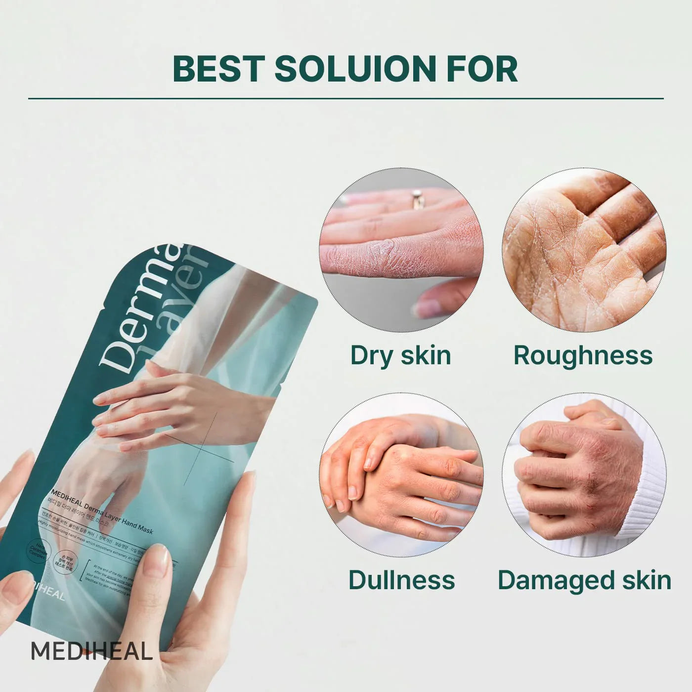 Mediheal Derma Layer Hand Mask (Pack of 5)