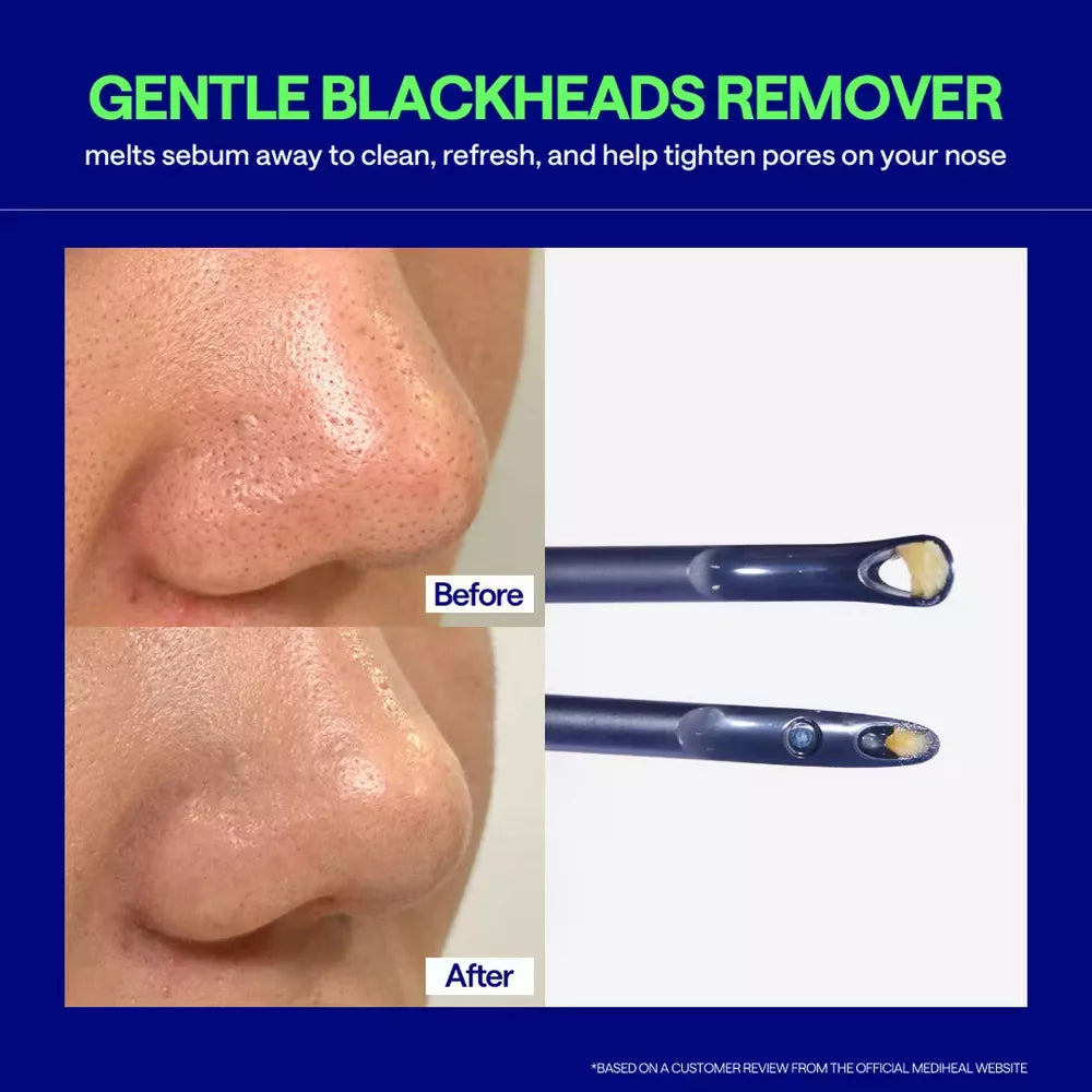 Mediheal Blackhead Melting Clear Nose Patch (Pack of 4) - 3 Step Blackhead Care Kit, Tool Included