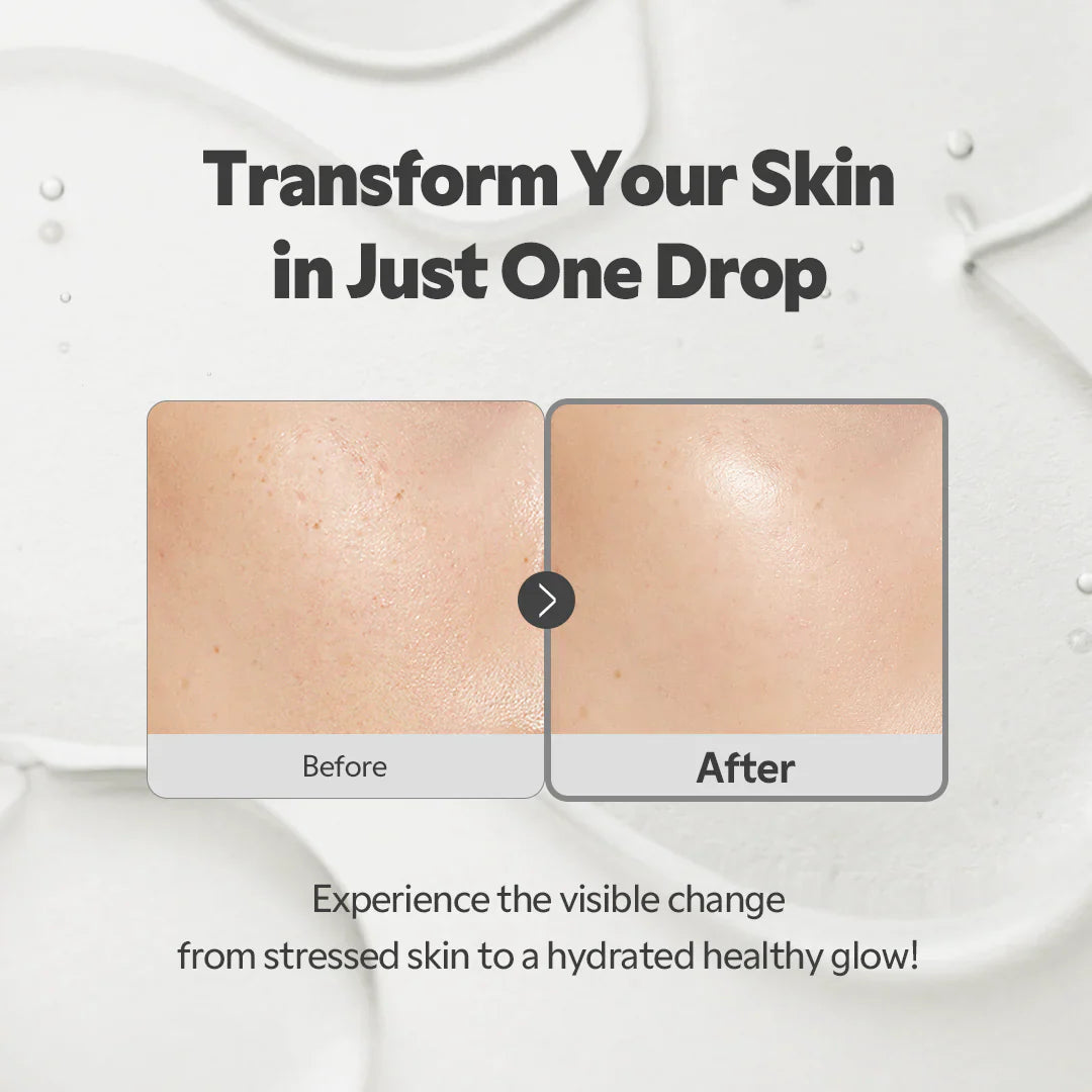 TIRTIR SOS Serum - Radiant Glow Boosting, Plumping, Anti Aging, Hydrating Face Serum