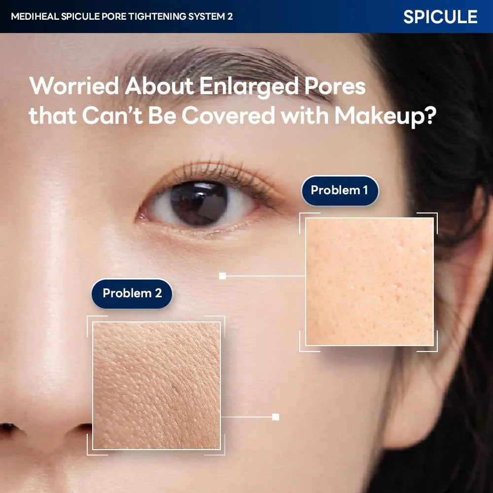 Close-up of enlarged pore concerns targeted by Mediheal Spicule System 2
